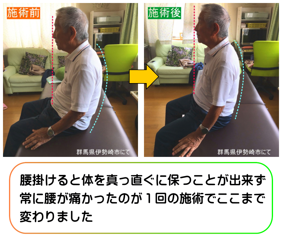 1回の施術で腰痛を解消し腰が立つようになりました